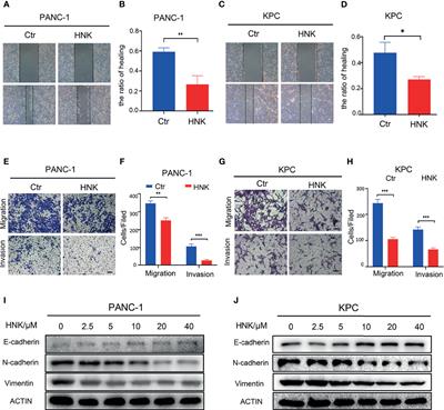 Honokiol Suppresses Perineural Invasion of Pancreatic Cancer by Inhibiting SMAD2/3 Signaling